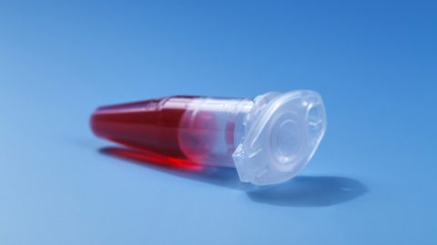 Sample of Blood used in Regenerative Medicine Therapy