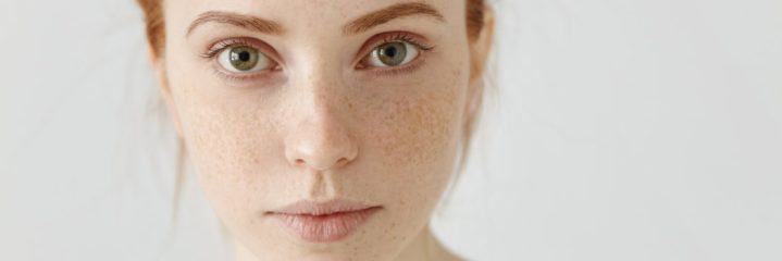 A young woman with red hair, green eyes, and freckles, wearing a white and black striped shirt, looks directly at the camera against a plain light background.